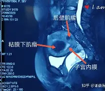 包含萨拉赫CBA下课的七位赛后发声的词条|乐鱼网站